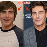 What Happened To Zac Efron Accident: Misled By Horrible Savaging